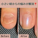 アクアリュース(Aquqrius)