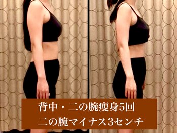 サロン セドナ(SALON SEDONA)の写真/【秋冬花嫁】10・11・12月挙式に◎まだ間に合う！二の腕・背中・肩甲骨集中ブライダル痩身本気痩身◎