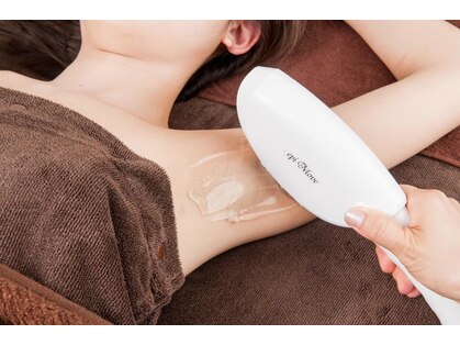 ロス(Loss)の写真