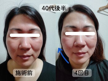 リンパサロンつむぐ/フェイスラインもお肌もアップ