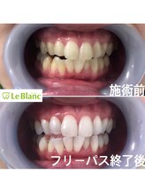 ルブラン 奈良店(Le Blanc)/集中ケア！！