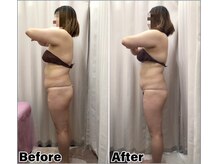 ベルミーランド MEGAドン・キホーテ草加の雰囲気(痩身1回目→4回目)