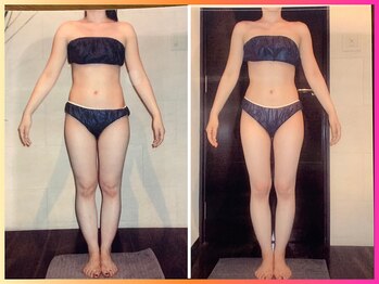 ベリンダ 銀座店(BELINDA)/☆ビフォーアフターのご紹介☆