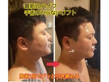 強め筋膜痩身リンパ 小顔エステBAR北野/