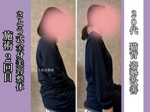 さとう美容整体 町田店の雰囲気(全身整体で姿勢改善♪巻き肩・猫背・反り腰など)