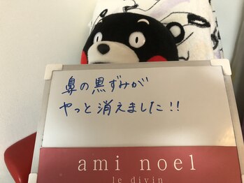 アミノエル/毛穴/ニキビケア/赤ら顔改善へ