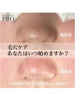 ムク(MUKU)/5年後、10年後のお肌のために