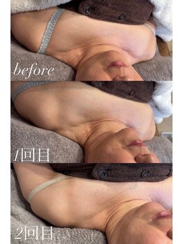 アイラッシュサロン ココ(CoCo)/ディレイアゼル2