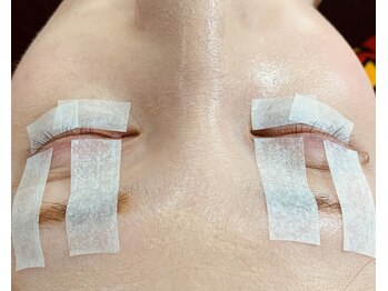 ケアフリーダム(CareFreeDom)/◇ビフォー◇(まつげが少ない方)