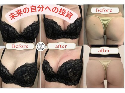 ベルスパ(BELL SPA)の写真