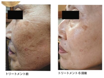 トータルスキンケア 美容ルーム(美容Room)の写真