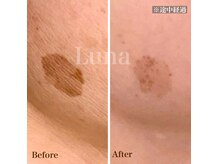 ルナ(Luna)の雰囲気（何をしても変わらなかったお悩みに）