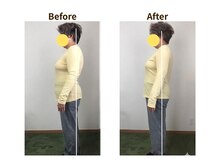 フェルナ(FERNA)/Before/After