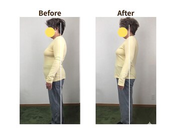 フェルナ(FERNA)/Before/After