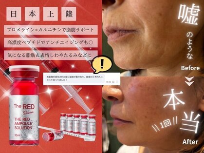 スズ(SUZU)の写真