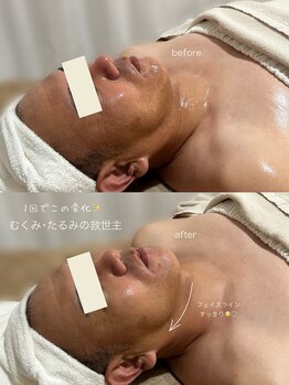スパ ナナプラス(SPA nana+)/小顔リフトフェイシャル