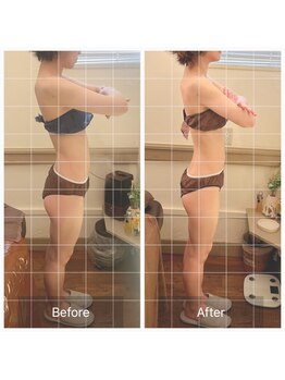 カルナ(carna)/《4か月計8回》2週間に1回