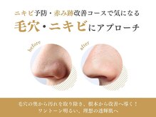 エステ ココ 錦糸町店(Esthe CoCo)の雰囲気（ハーブピーリングで毛穴や凸凹肌の改善♪本格的な肌質改善）