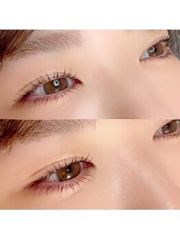 リスタ 飯塚店(Lista)/上下コスメリフト