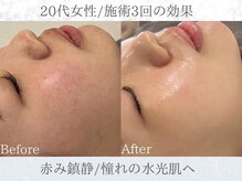 ルミア 目白 池袋(Rumia)の雰囲気（【クリスティーナ正規取扱店】カウンセリングのみも可能です◎）