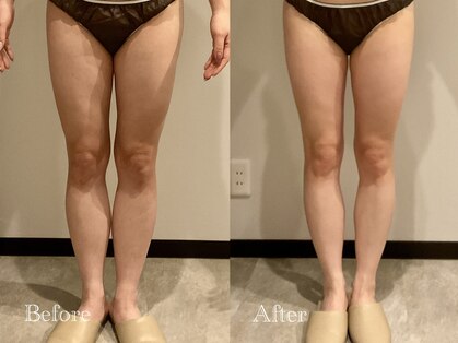 エステティック ミュー(Esthetic MiEUX)の写真