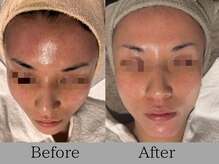 ルミライズ(lumirise)/ 〈１０回目での効果〉