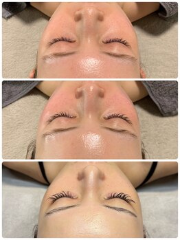 ラグ(LUXU)の写真/《ベテランエステティシャンだからできる肌見極め×結果出し》速攻で艶出し！韓国に行かずとも肌管理を◎