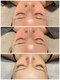 ラグ(LUXU)の写真/《ベテランエステティシャンだからできる肌見極め×結果出し》速攻で艶出し！韓国に行かずとも肌管理を◎