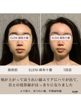 エレーニ 麻布十番(ELENI)/頭蓋骨小顔コルギ/港区/麻布十番