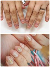 ココ ネイル サロン アンドスクール(COCO.NAIL SALON＆SCHOOL)/爪噛みケア7700