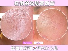 カンナムビューティーの雰囲気（表参道/ララピール/ハーブピーリング/小顔/耳つぼジュエリ-/毛穴）
