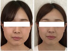 美容整体 ウェリナ 蟹江院/小顔矯正/骨盤矯正/美脚サロン 