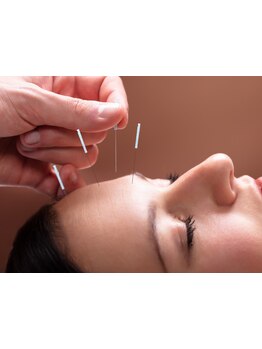 小顔になりたい