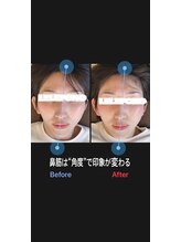 美容矯正サロン レレポノ(LELEPONO)/