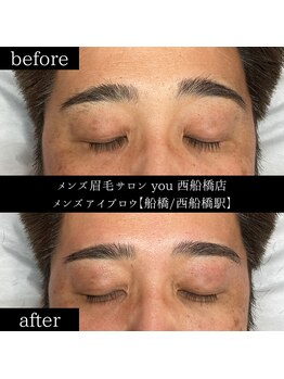 ユー 西船橋店(you)/ビフォーアフター写真
