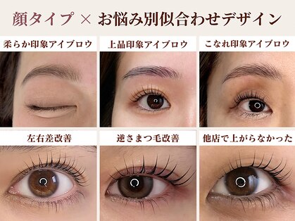 シャルリス(CHALELISS)の写真