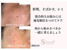 セメ(S'aimer)の雰囲気(肌悩みは複合的。まずは肌状態を確認して優先順位をつけてケア)