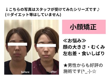 骨盤スタイル鍼灸整骨院 武蔵新城院(骨盤STYLE鍼灸整骨院)/小顔矯正