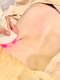 マノマノ エミュー(manomano emu)の写真/【歴10年以上ベテランエステティシャンが驚いた結果出し！】1台で5台分!?圧倒的な美しい見た目を手に☆