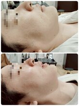 縁(en)/メンズ　レモンボトル