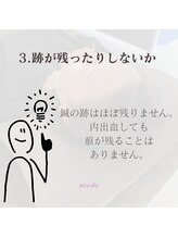 ニコディア(nico-dia)/跡が残ったりしないか☆