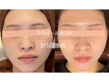 ライフサロン 恵比寿(Life Salon)/ララピール×LDM