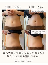 ナチュモア(natyumoi)/続けることで変わる腸★