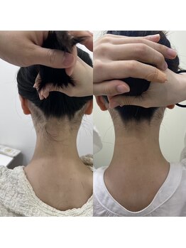 ミース 京都駅前店/うなじビフォーアフター