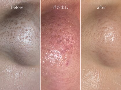 アネラ(ANELA)の写真