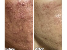 ミミルーチェ 中目黒(mimiluce)の雰囲気（肌質改善に特化してる若よもぎ蒸し◎普通のよもぎではありません）