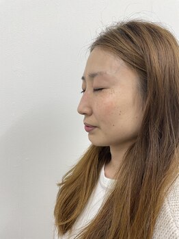 ナノハナ/鹿沼市の全身脱毛美容室ナノハナ