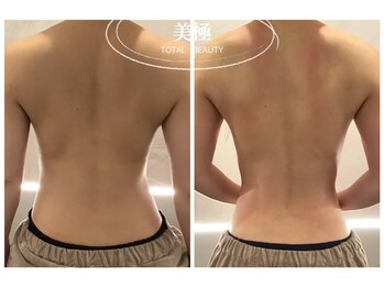 美極 銀座店/銀座/小顔コルギ/小顔矯正