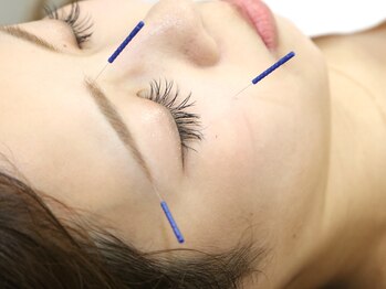 フォーユー 門真院(for you)/自分史上1番の小顔へ