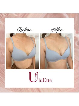 ウルエッテ(UluEtte)/背中のお肉はバストです/福岡